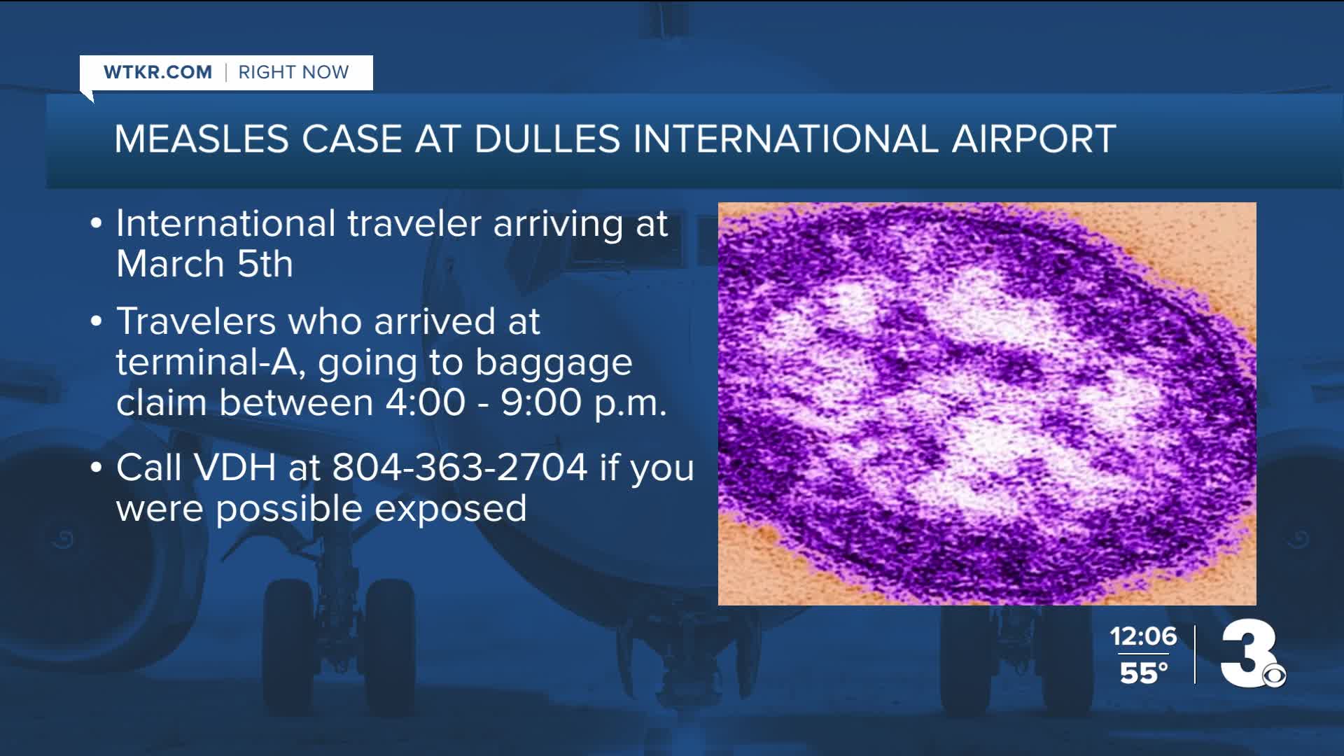 officials-investigating-potential-measles-exposure-at-dulles