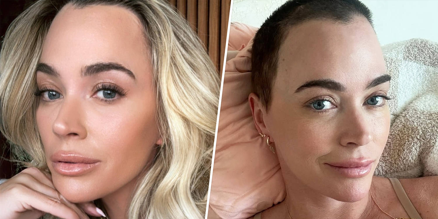 Teddi Mellencamp’s cancer journey, from melanoma diagnosis to brain and