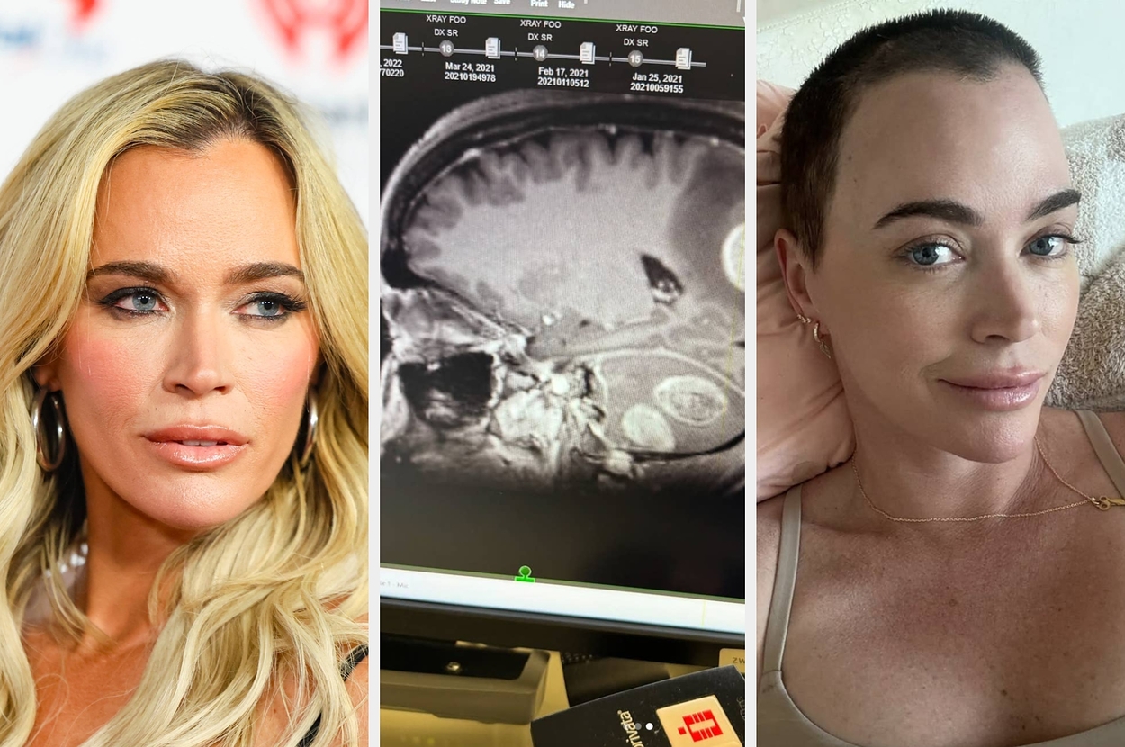 “Real Housewives” Star Teddi Mellencamp Reveals She's Been Diagnosed