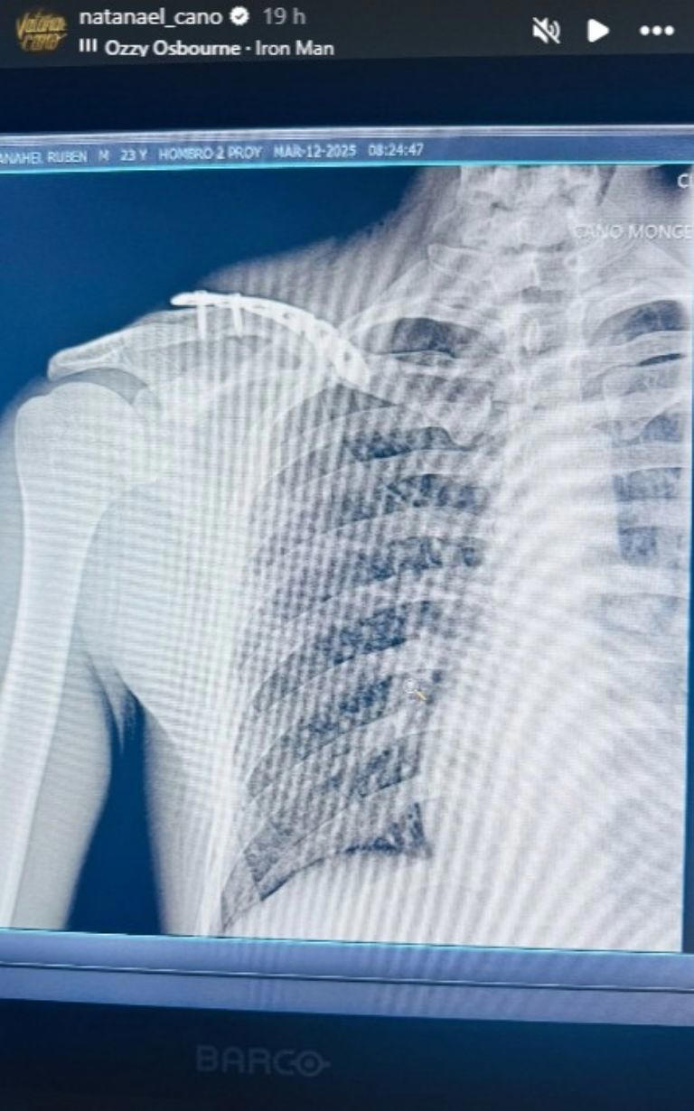 El cantante sufrió un accidente. Foto: Instagram/@natanael_cano