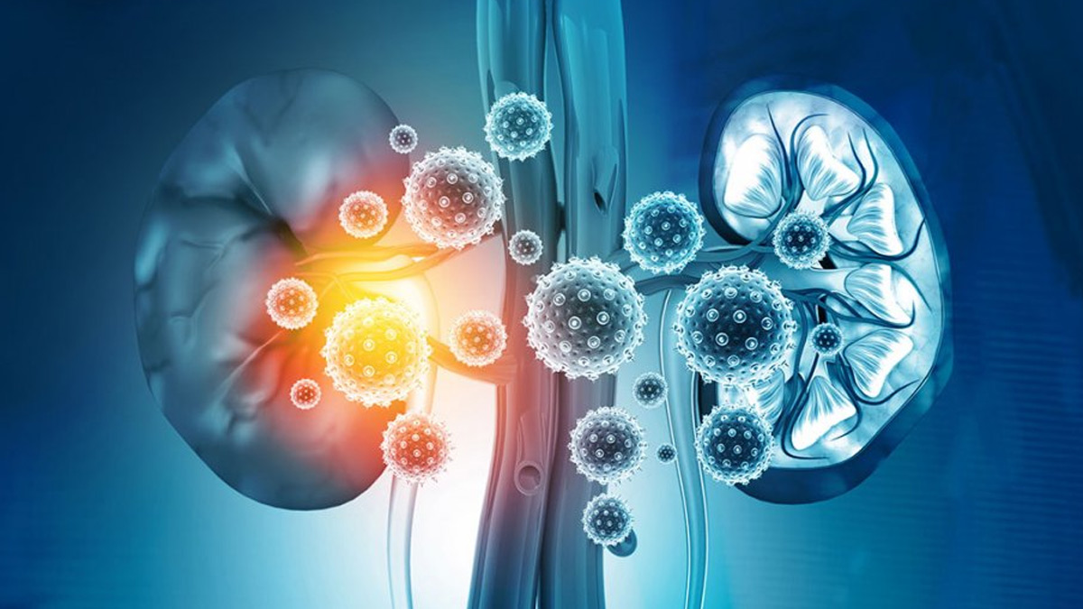 Kidney Failure Symptoms Early Warning Signs You Shouldn’t Ignore