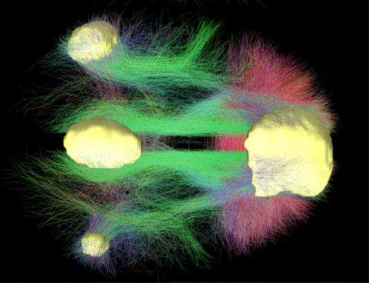 Cos’è la coscienza? Il più grande mistero delle neuroscienze