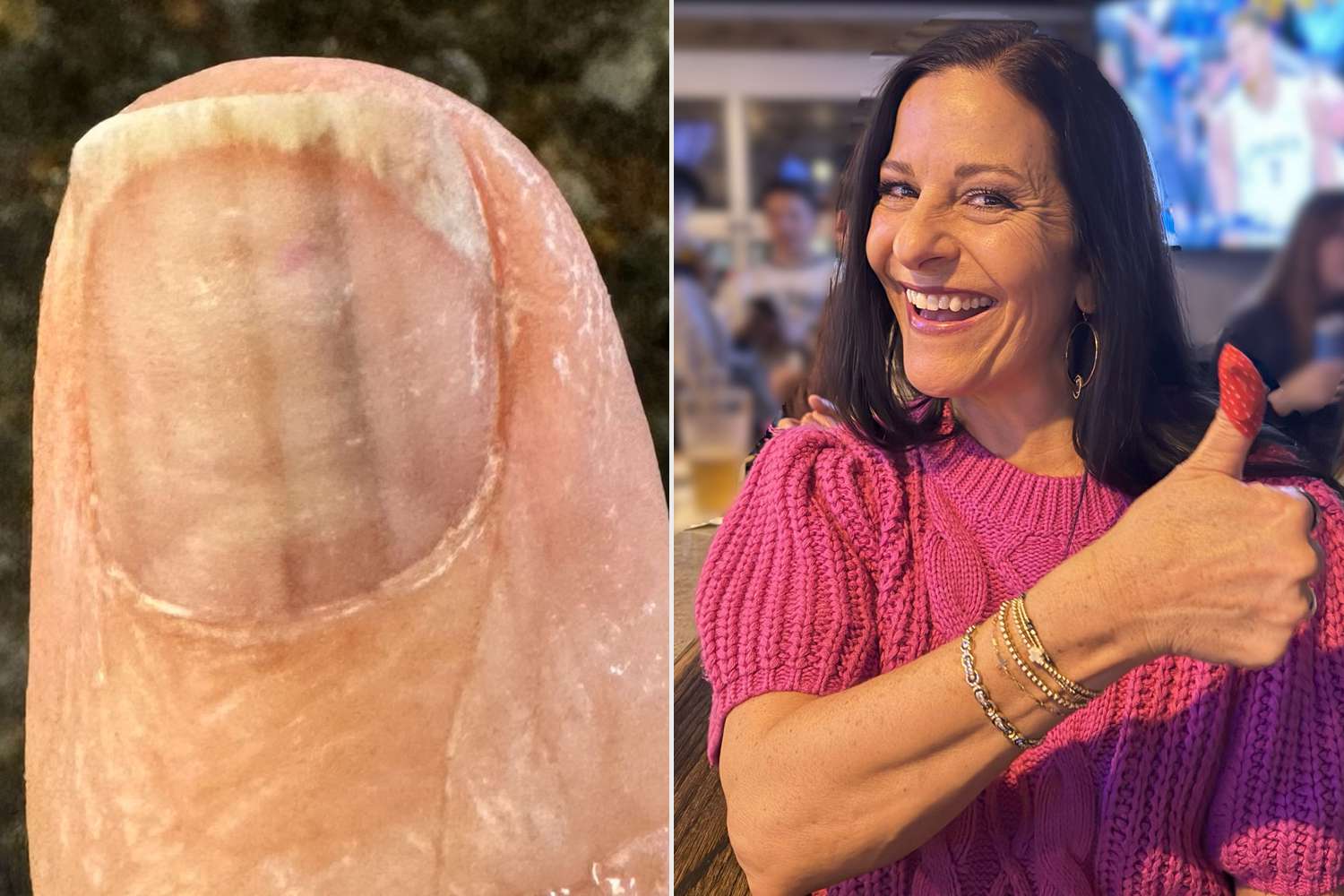 Ohio Mom Discovers Cancer Deep in Her Thumb — and the Only Sign Was 2