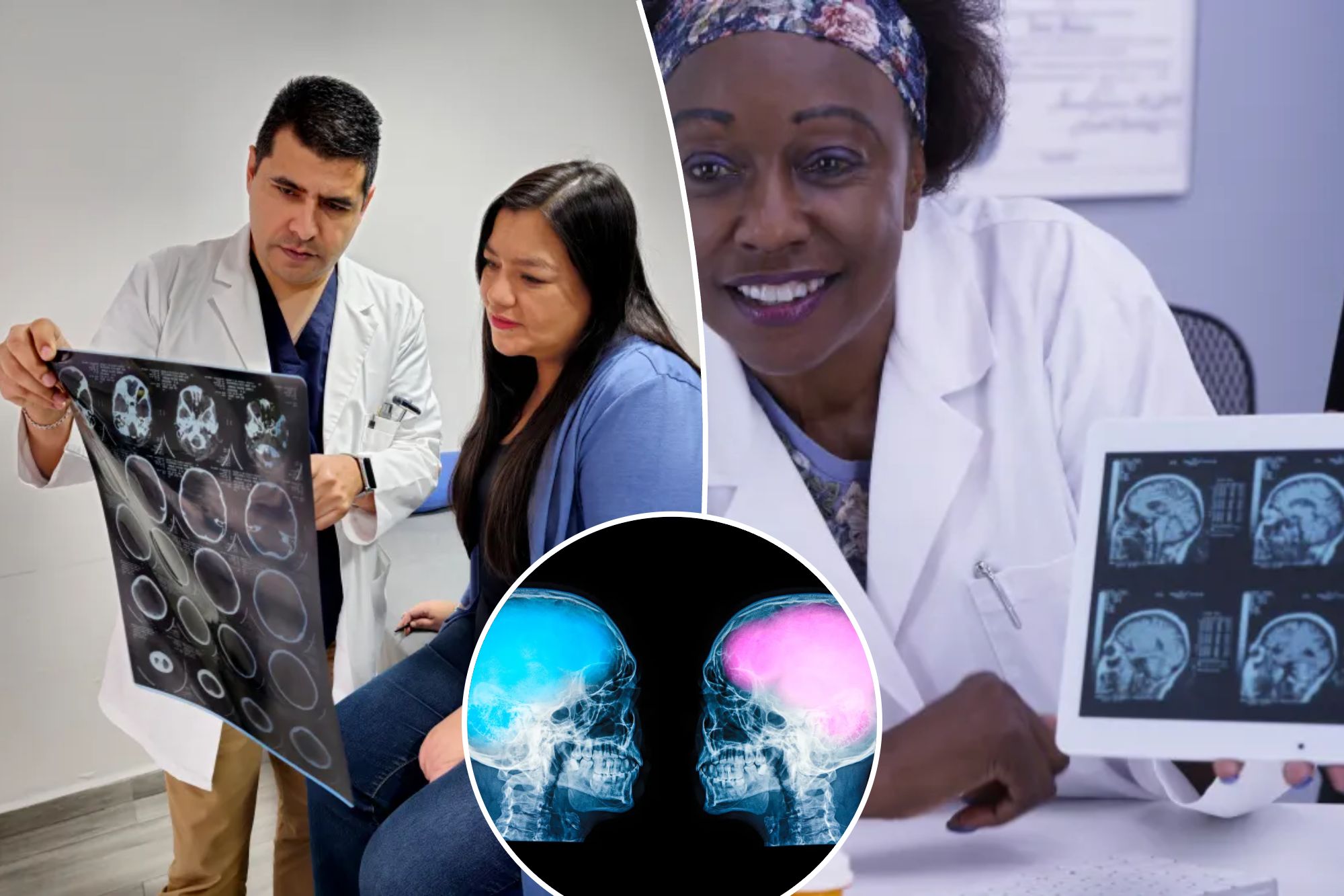 Scientists discover key to why women’s brains age better than men’s(01)