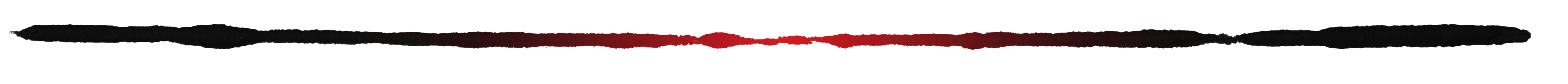 AA1Axdr4 "Did My Daughter Survive?" Family Demands Change After Near-Fatal Dog Attack