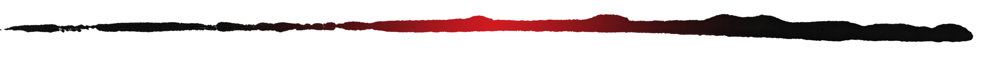 AA1Axdro "Did My Daughter Survive?" Family Demands Change After Near-Fatal Dog Attack