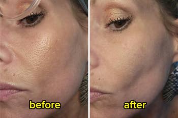 Close-up comparison of a woman's skin before and after using skincare, showing smoother texture in the after image