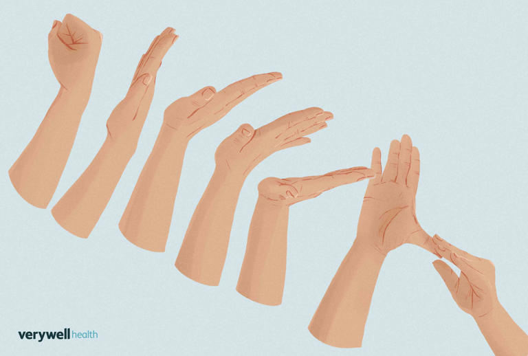 Ulnar nerve entrapment causes and treatment