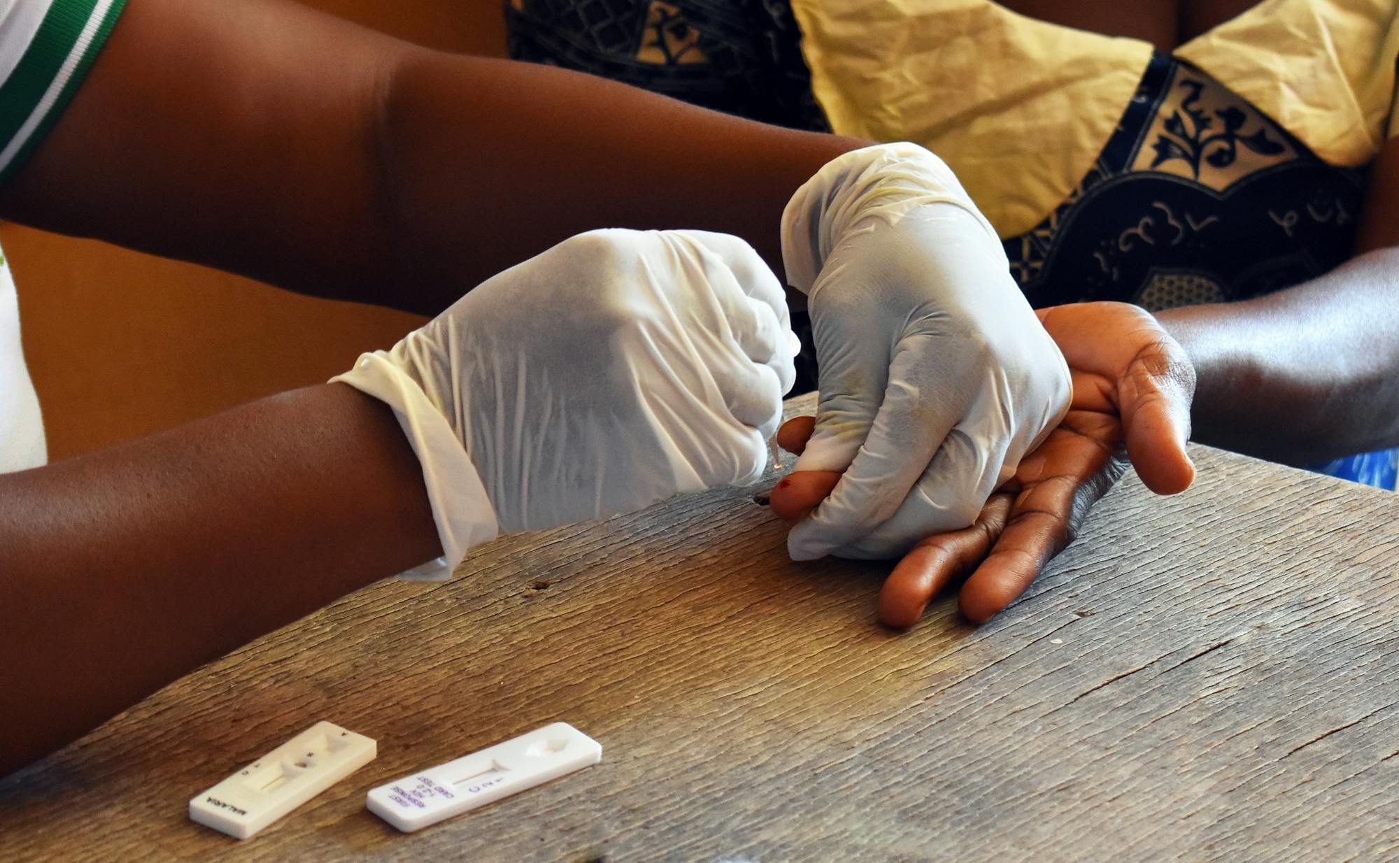 Foreign aid cuts could mean 10 million more HIV infections by 2030 ...