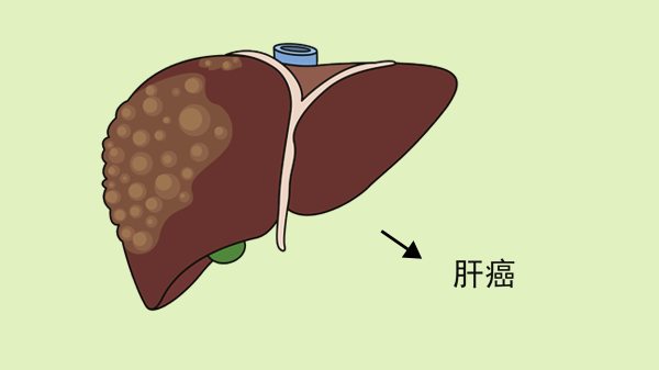 春天使劲吃，一杀菌，二通便，三保护肝脏，鲜嫩营养高，别不懂吃