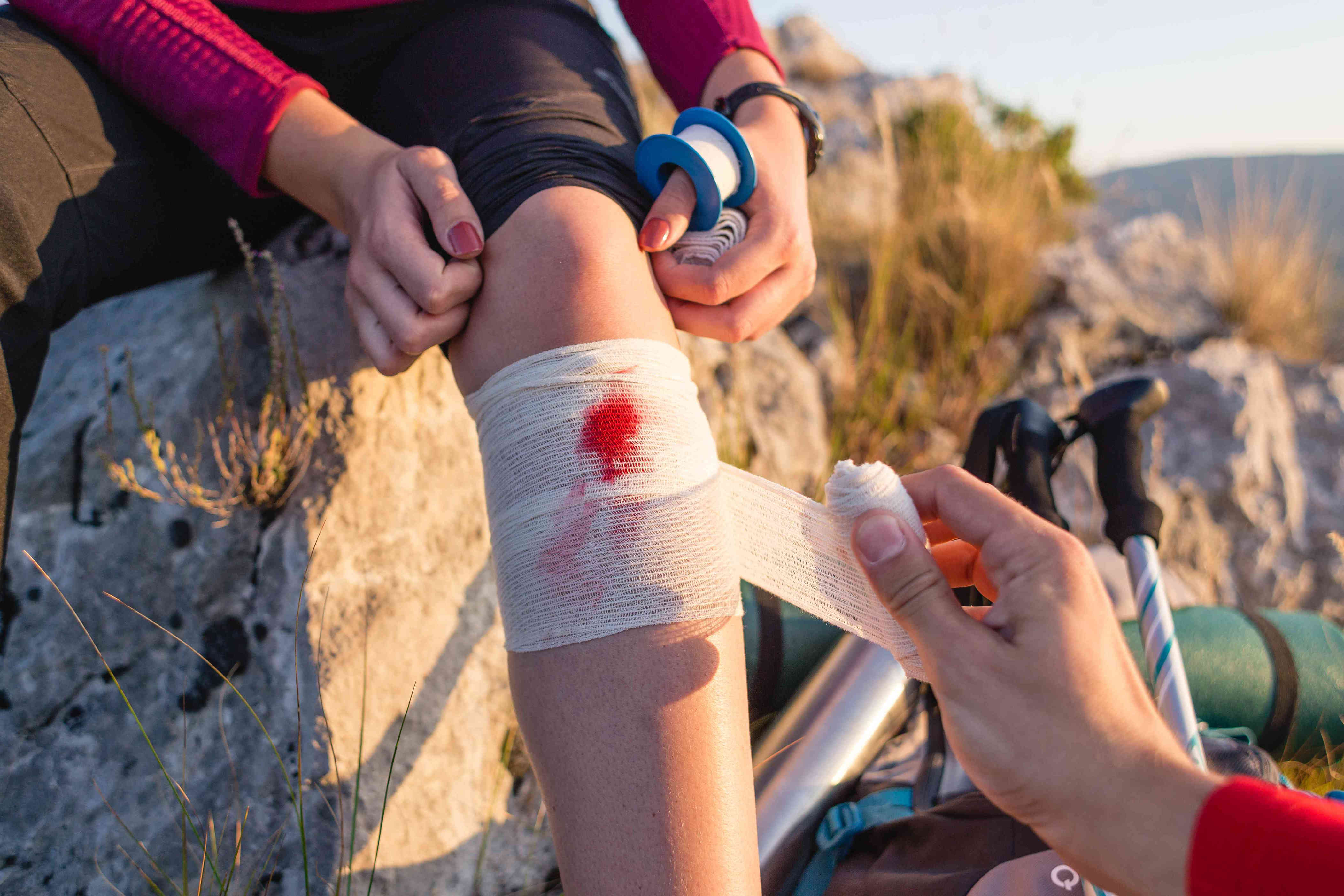 HEMORRHAGE EXPLAINED TYPES SYMPTOMS CAUSES AND CARE visual data 3