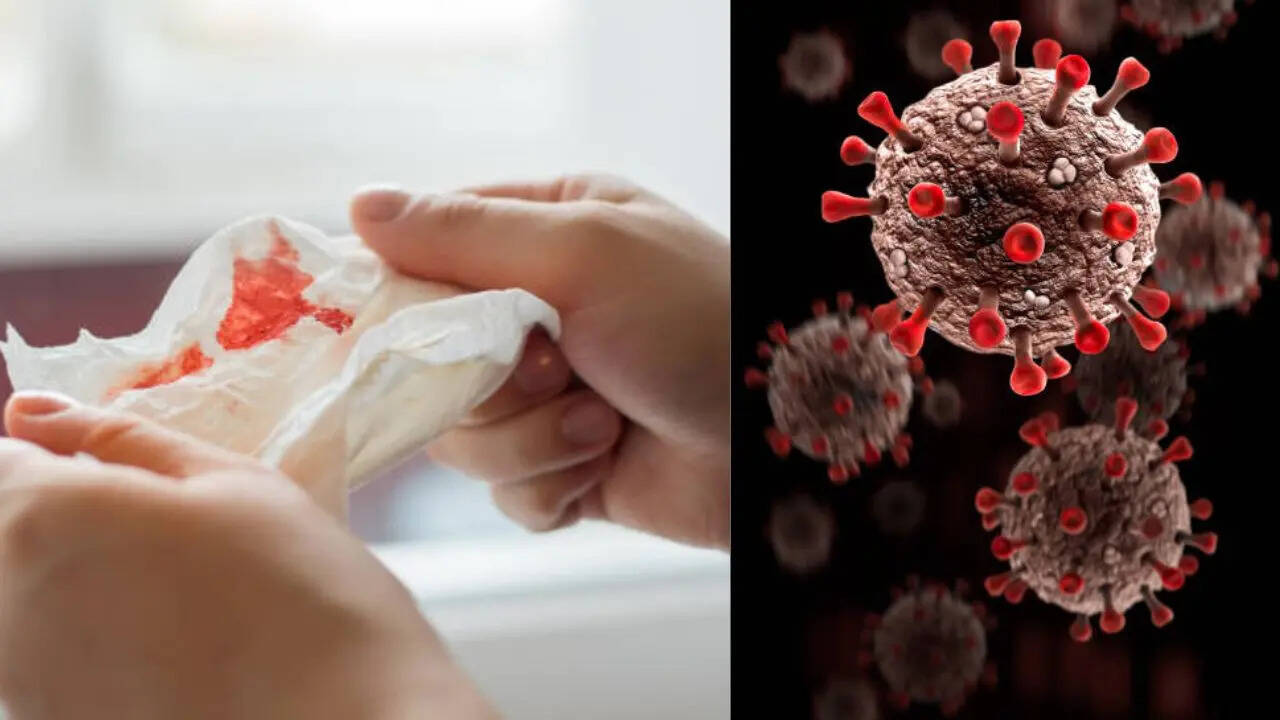 COVID19Like Mystery Virus Outbreak in Russia Leave Victims with High