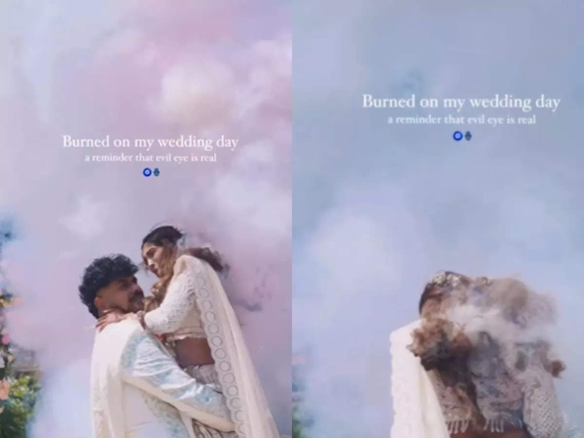 Couple’s epic photo shoot in Bengaluru goes wrong; Bride suffers burn(02)