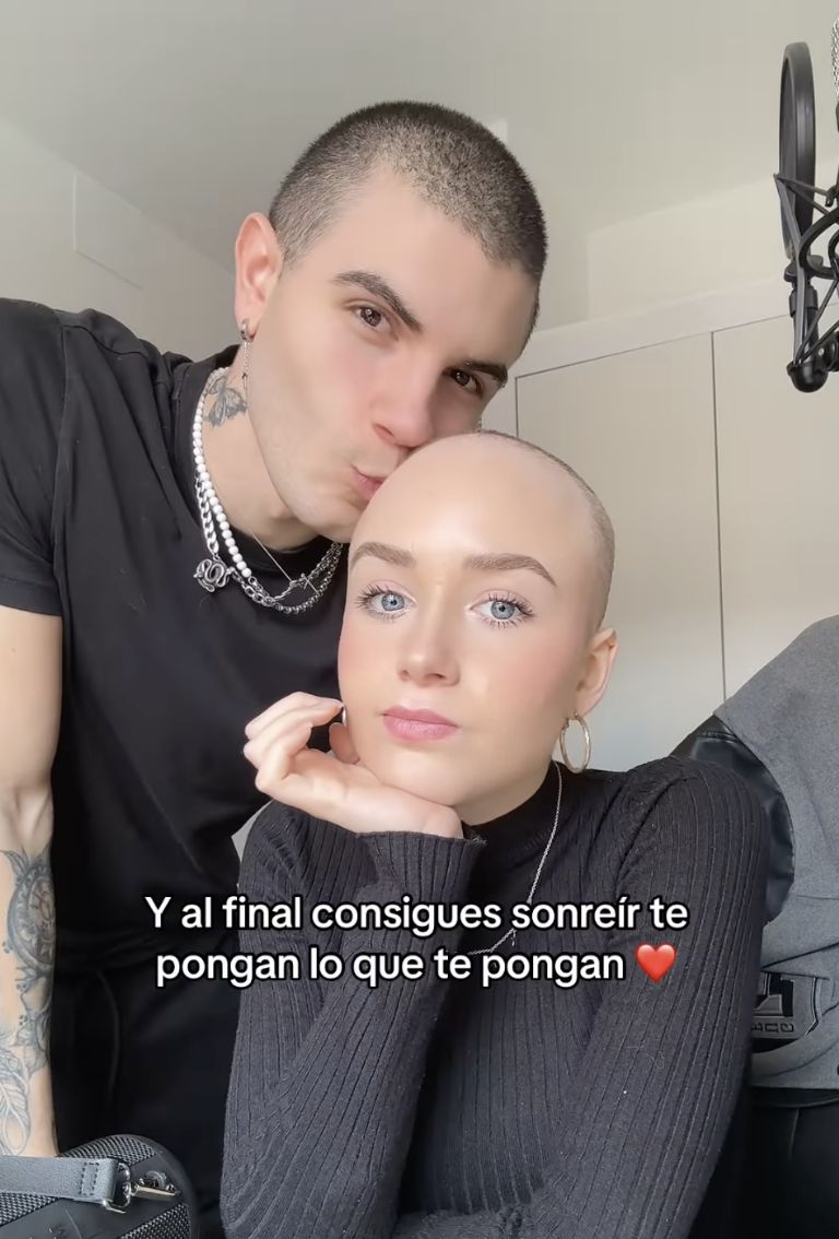 Novio de Natalia Jiménez se rapa como muestra de apoyo a la influencer en su lucha contra el cáncer. Foto: IG @nattjim