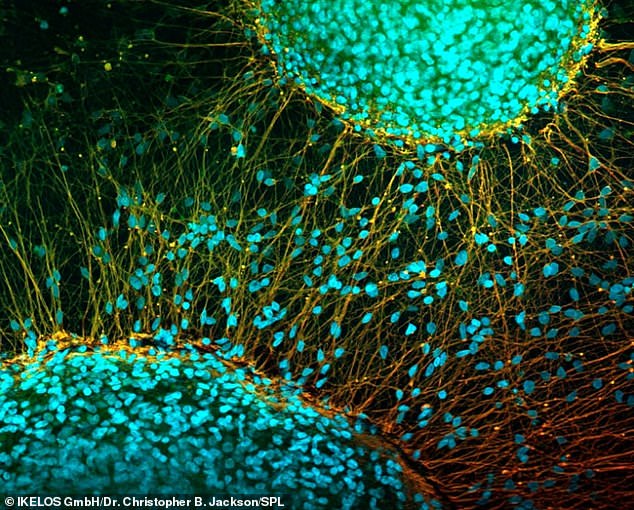 Nerve cells derived from induced pluripotent stem cells have the potential to reverse paralysis and have already helped one patient to walk again