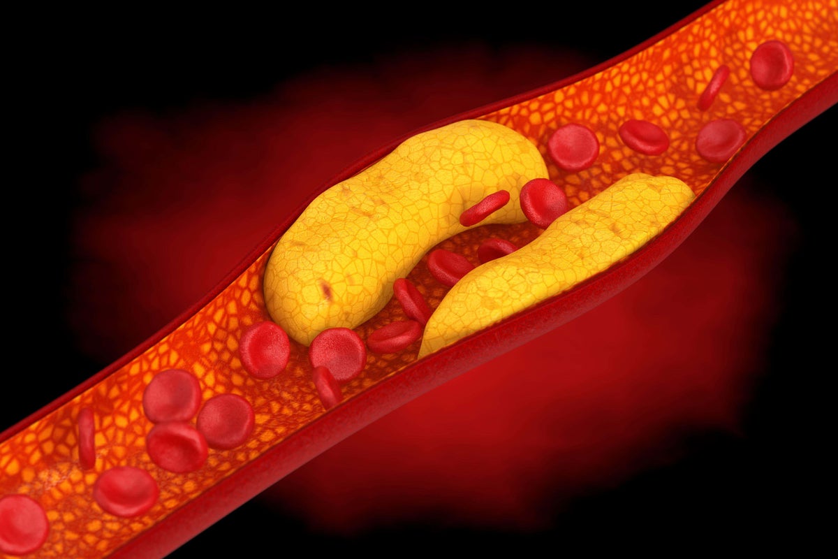 Experts reveal the truth about cholesterol and how it impacts your health