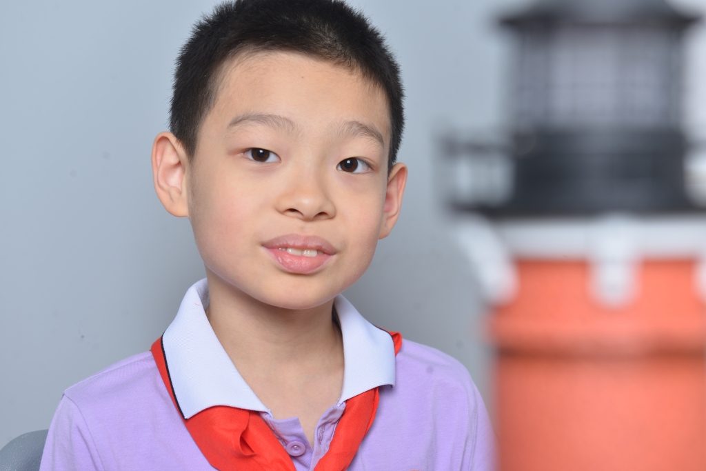 ��Ӱ��Ʒ�ľ�����˲����ֳ��Ա�֢��ͯ���ֺ�г��һ��