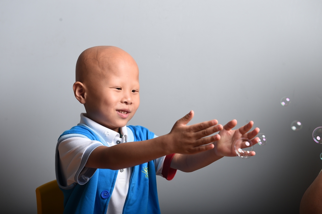 ��Ӱ��Ʒ�ľ�����˲����ֳ��Ա�֢��ͯ���ֺ�г��һ��