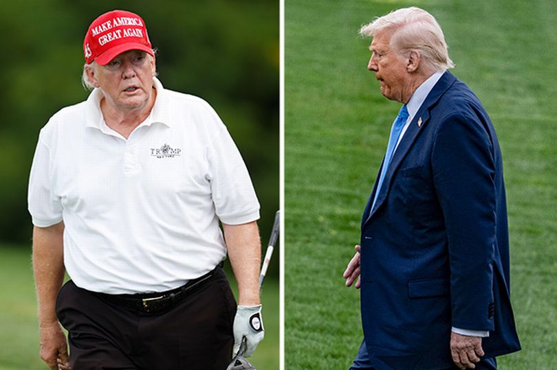 Donald Trump's drastic weight loss sign of 'serious condition', says(01)