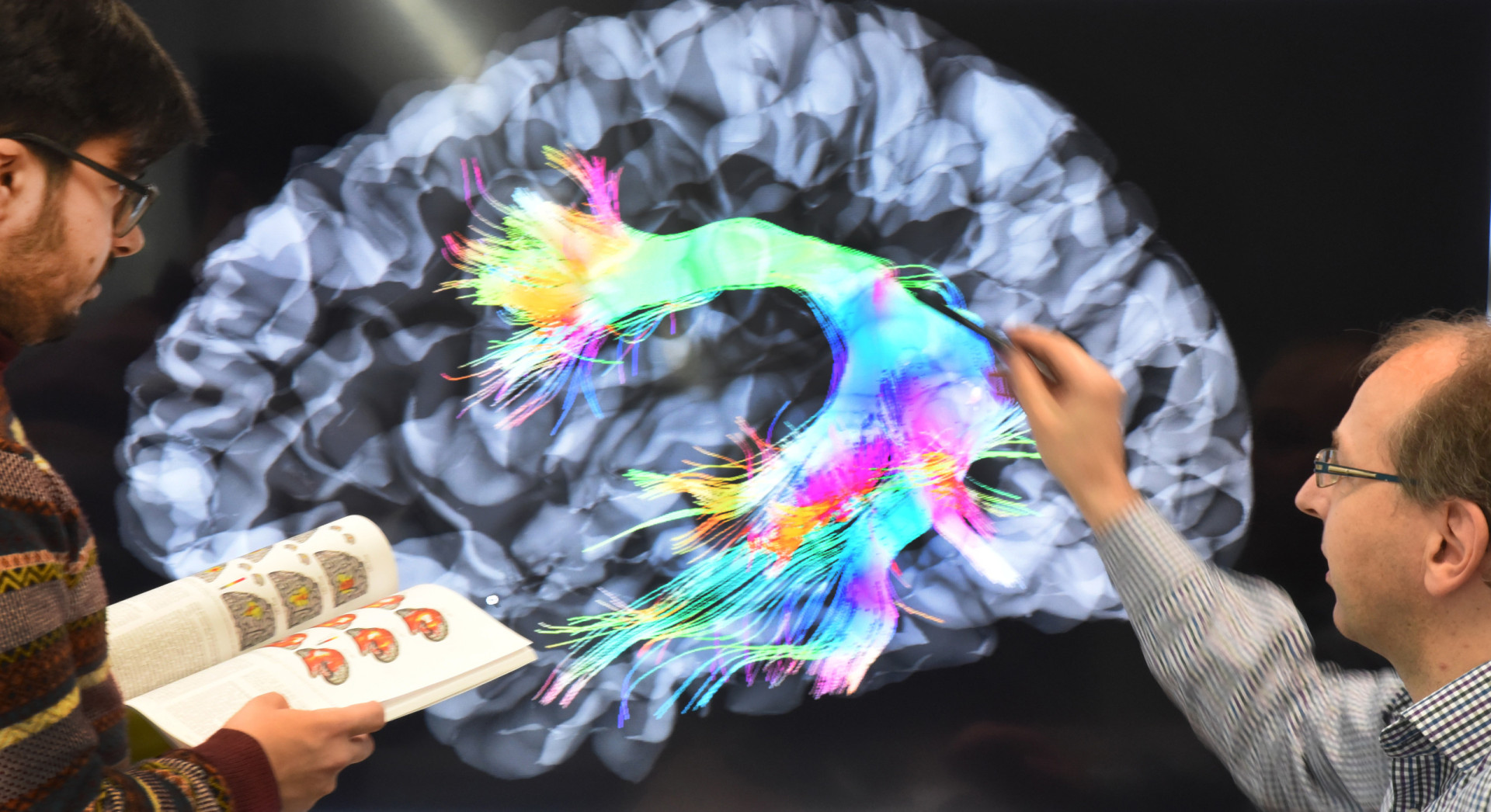 Are male and female brains different?