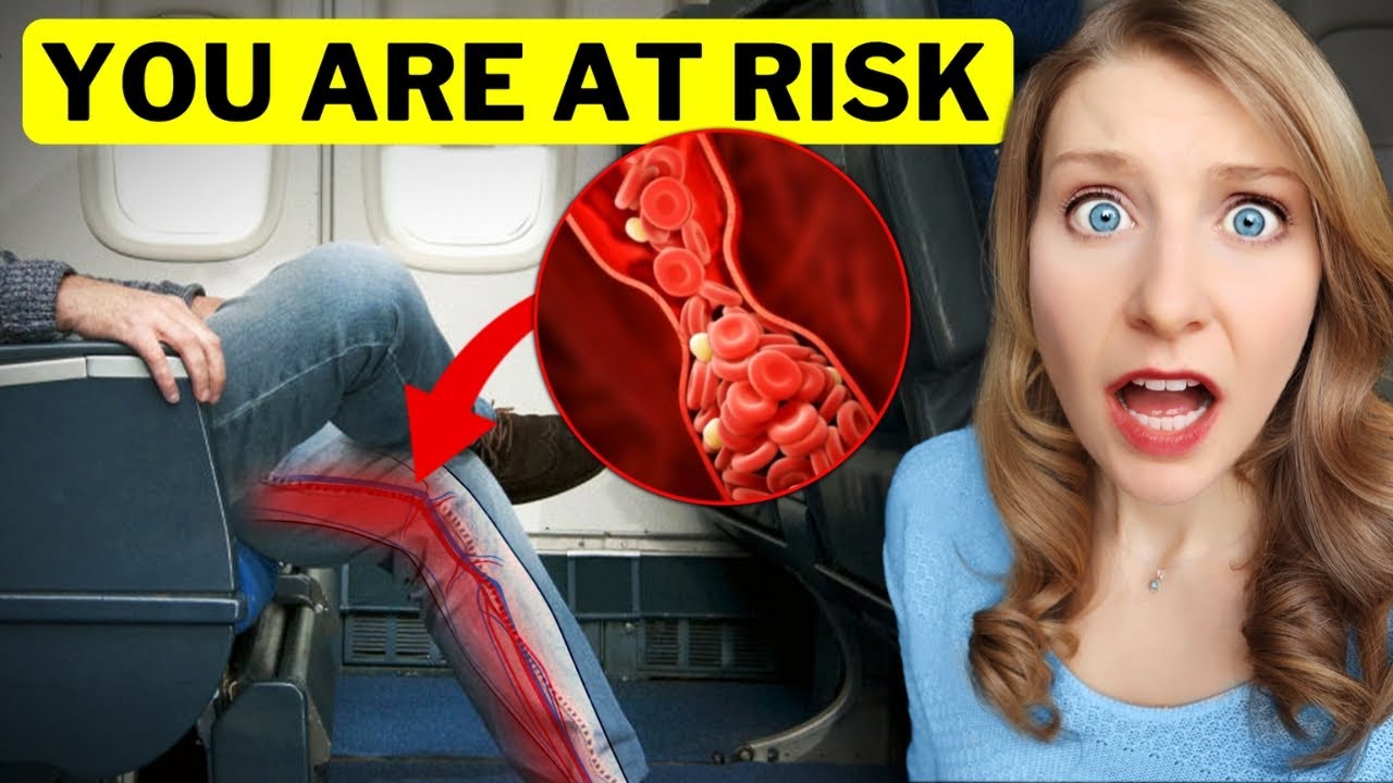 proven-method-to-avoid-blood-clots-while-flying