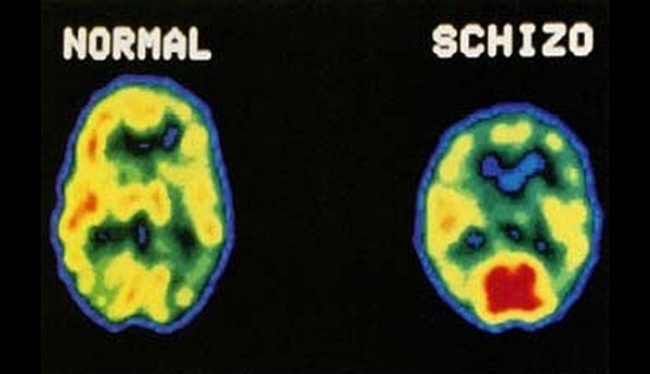 Tentang Tes Kesehatan Mental: Inilah 5 Ujiannya untuk Menjaga Jiwa Anda