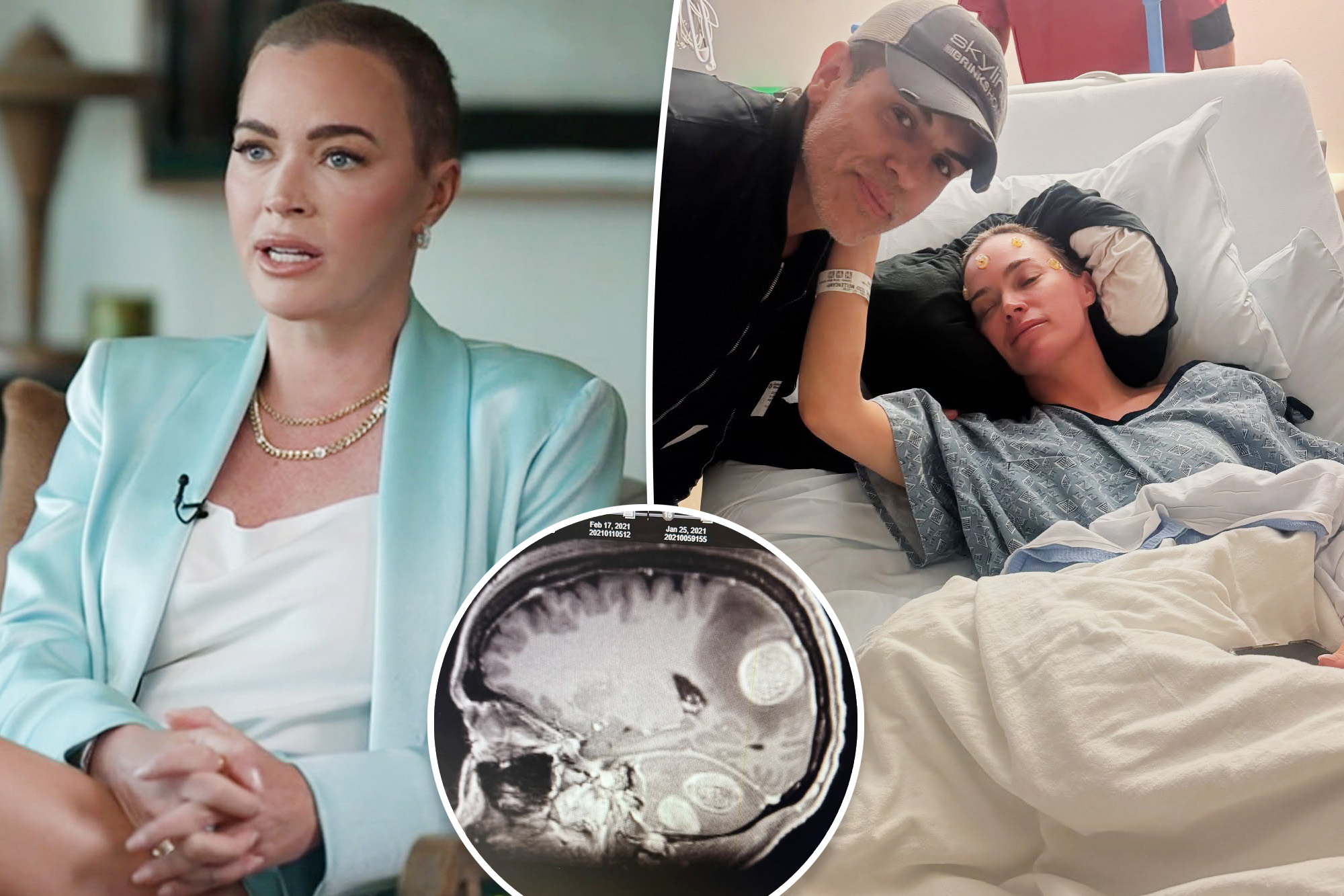 Teddi Mellencamp reveals doctors gave her ‘50/50’ odds of surviving