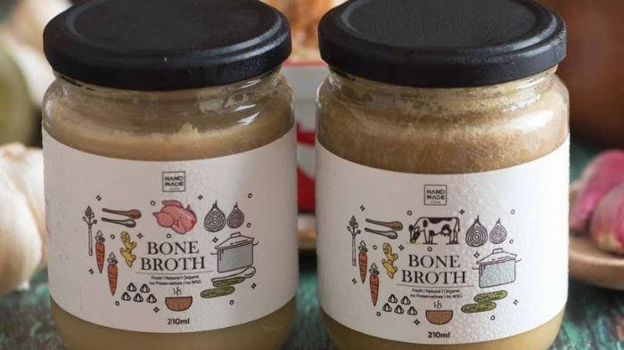 Apakah Iritasi Bayi Bisa Dicegah? Ini Penjelasan Dokter Anak