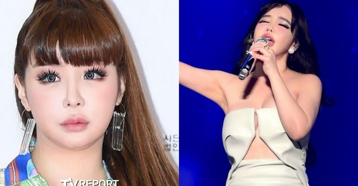 마지막 콘서트 무대 당시 박봄