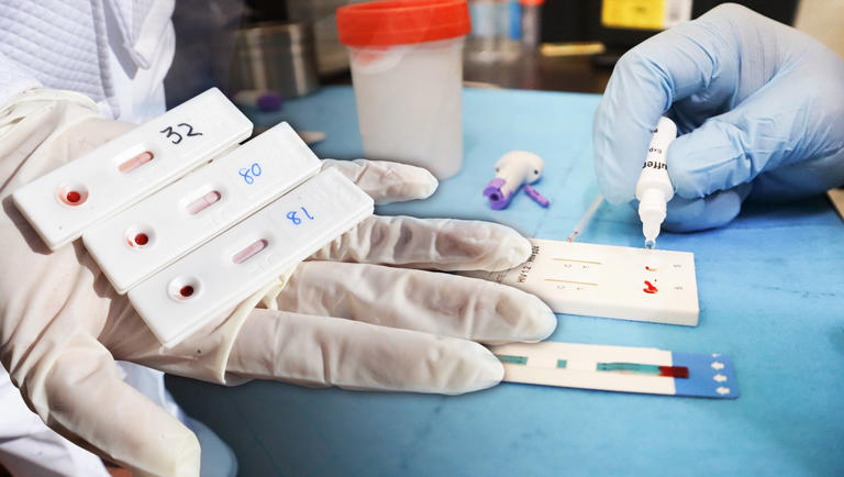 ¿Epidemia de VIH en México? Evolución de casos y situación actual del ...