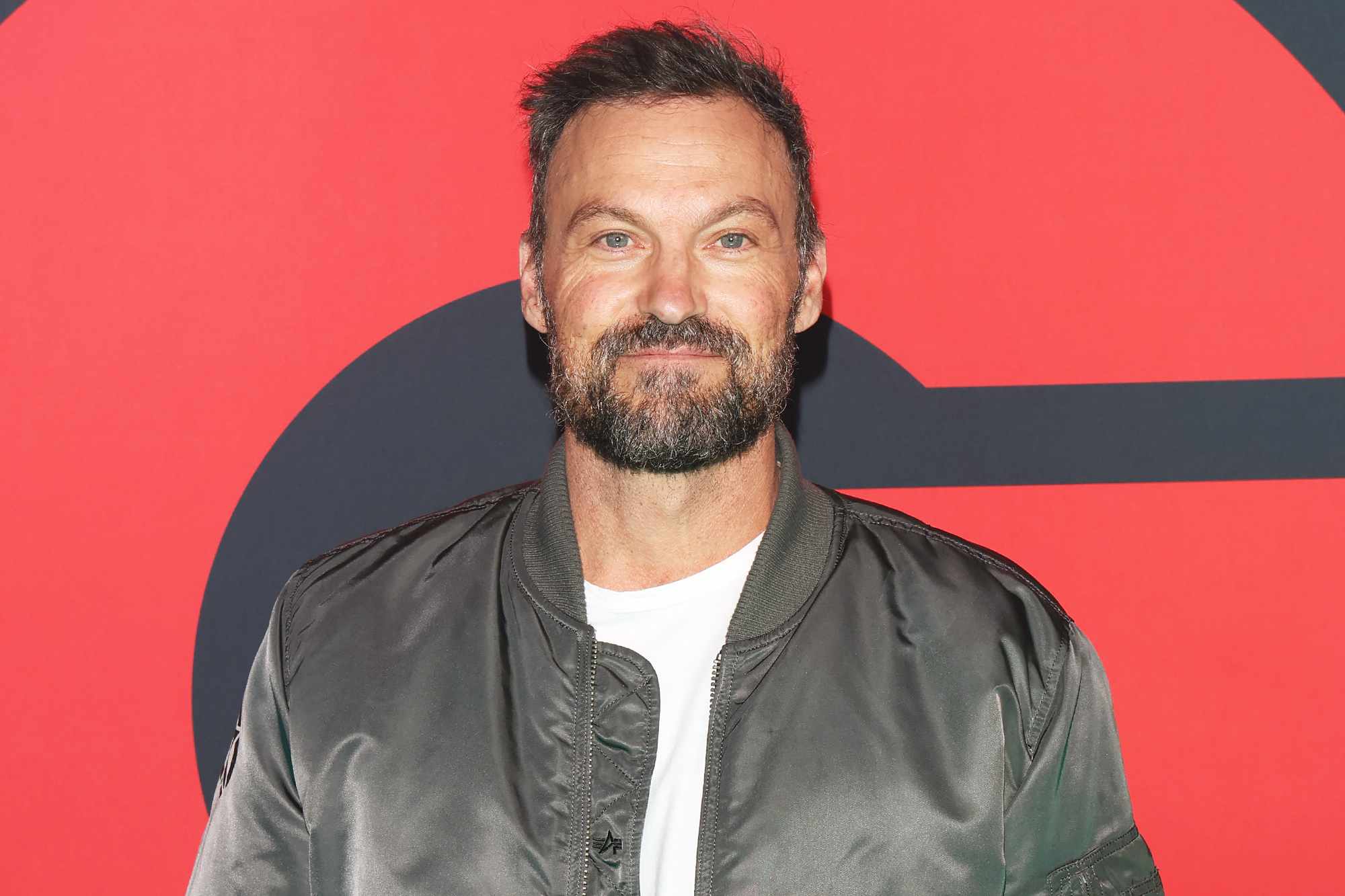Brian Austin Green is 'on the road to recovery' after emergency surgery