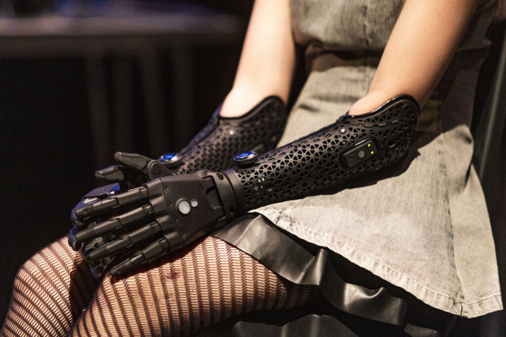 A teen model amputee has helped develop the world’s most state-of-the-art robotic arms – designed over four years and £2m research. (Pix via SWNS)