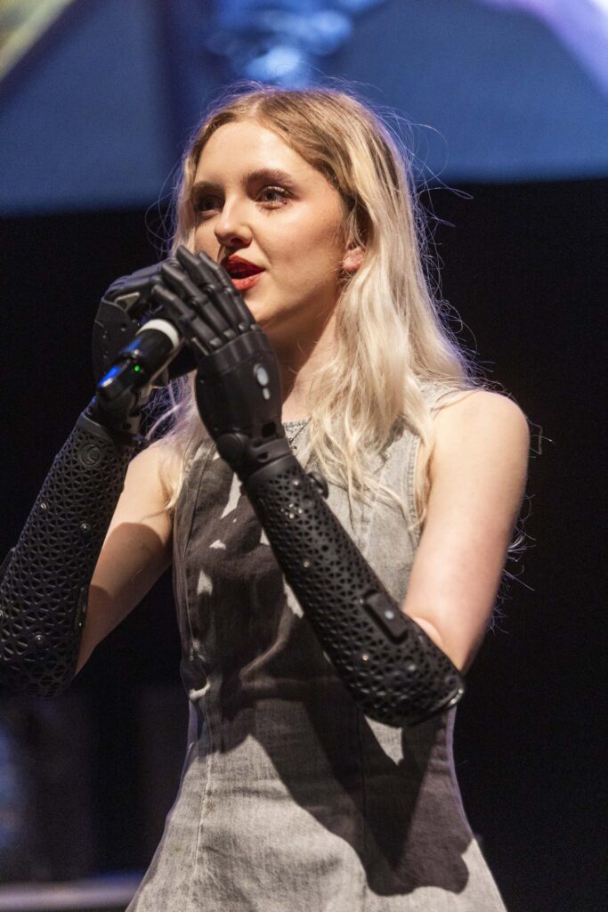 A teen model amputee has helped develop the world’s most state-of-the-art robotic arms – designed over four years and £2m research. (Pix via SWNS)