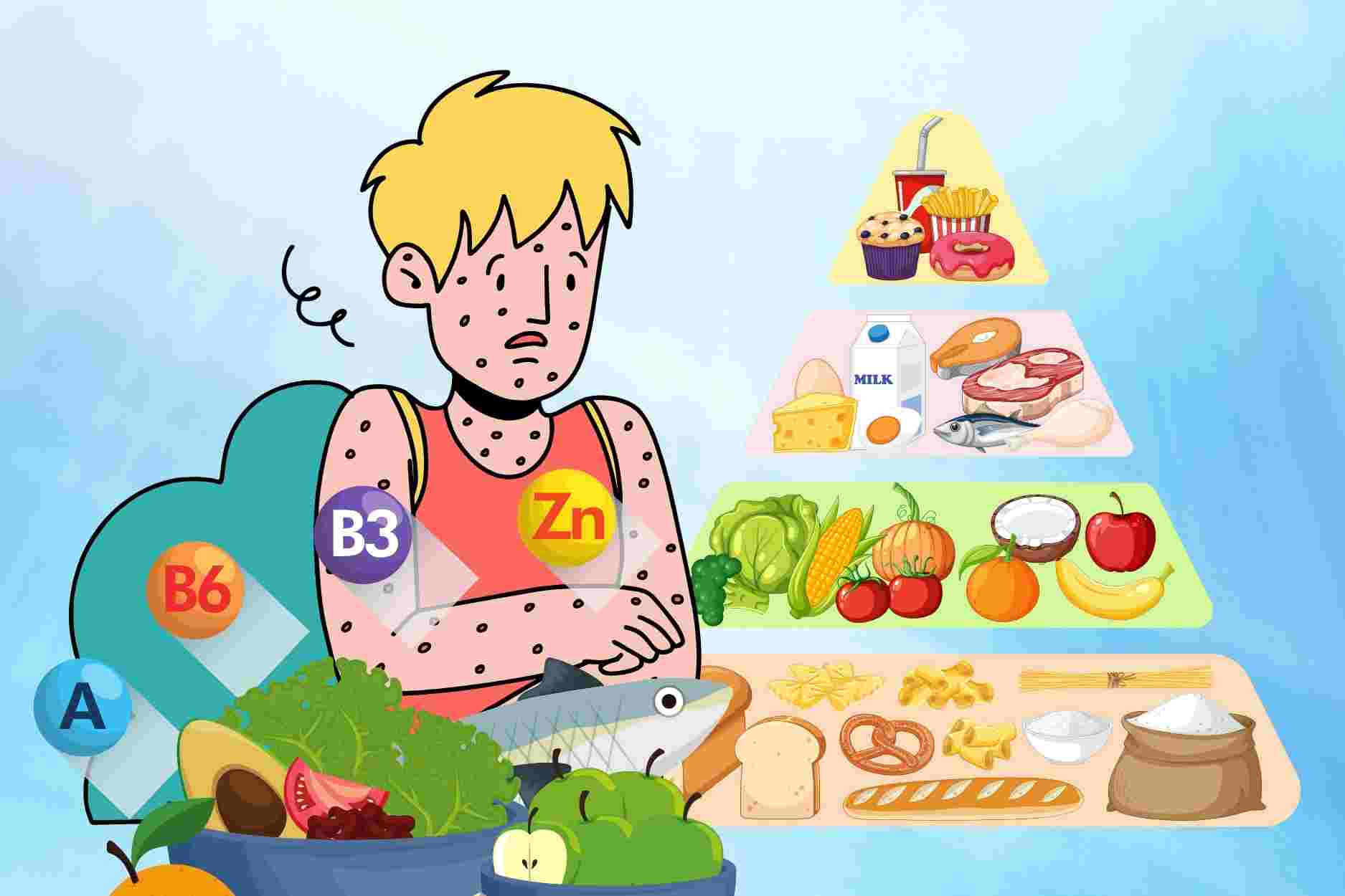 Dinh dưỡng giúp người bệnh sởi sớm hồi phục