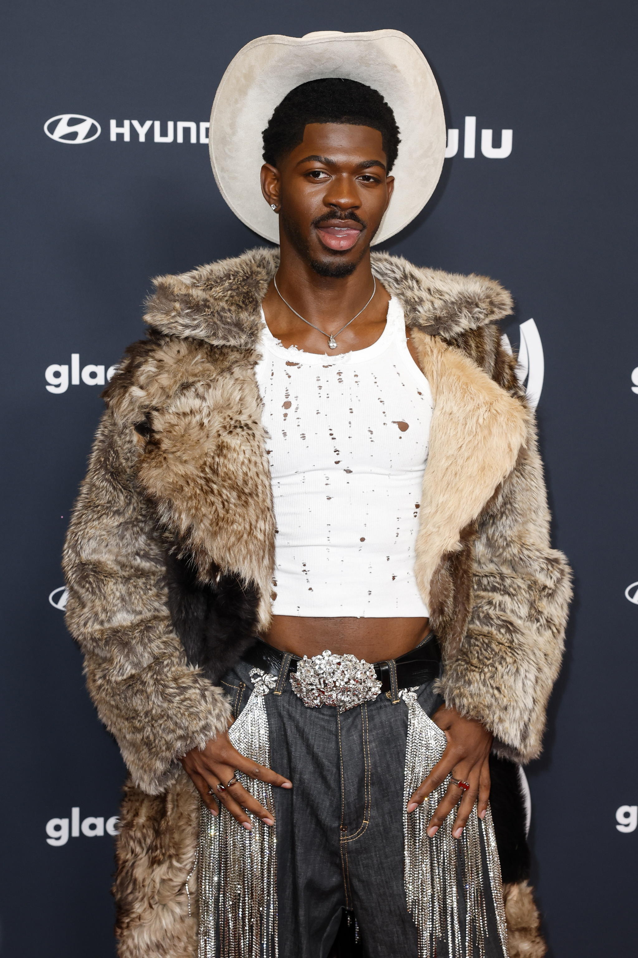 Rapper Lil Nas X ricoverato per paralisi facciale