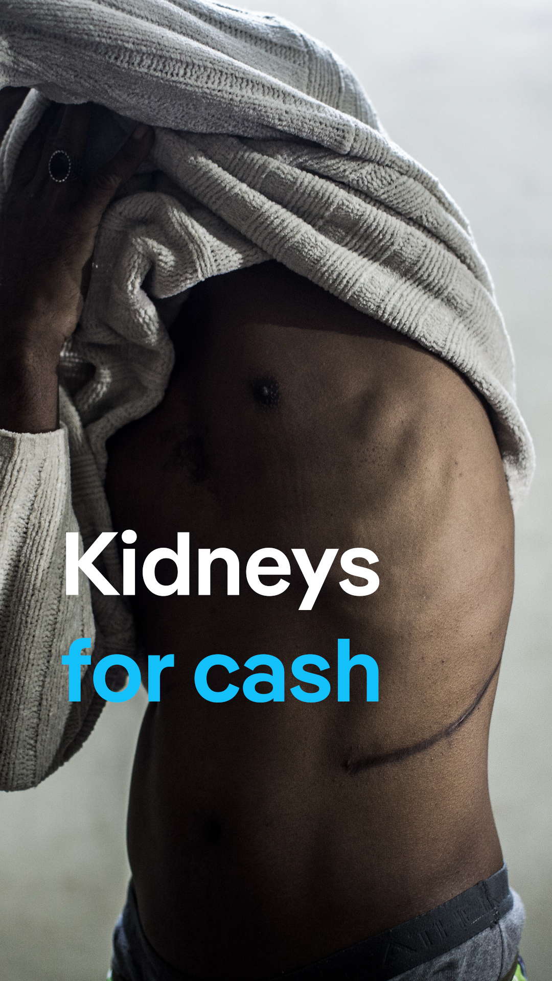 Uncovering a multi-million-dollar organ trafficking network