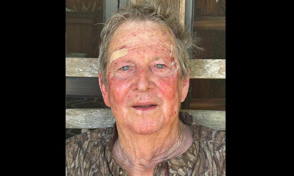 Hunter, 82, mauled by bobcat while calling turkeys