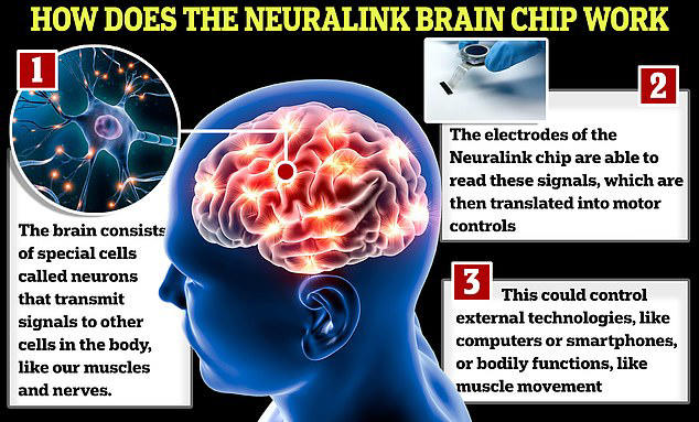 Neuralink's third brain implant patient regains speech with help from ...