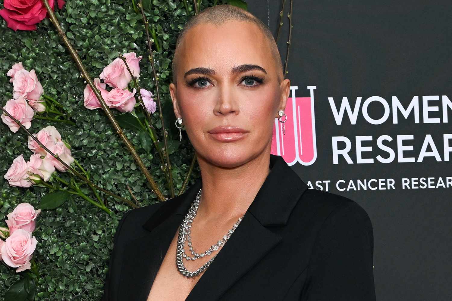 Teddi Mellencamp Says She Is Responding to Immunotherapy, but Will Have