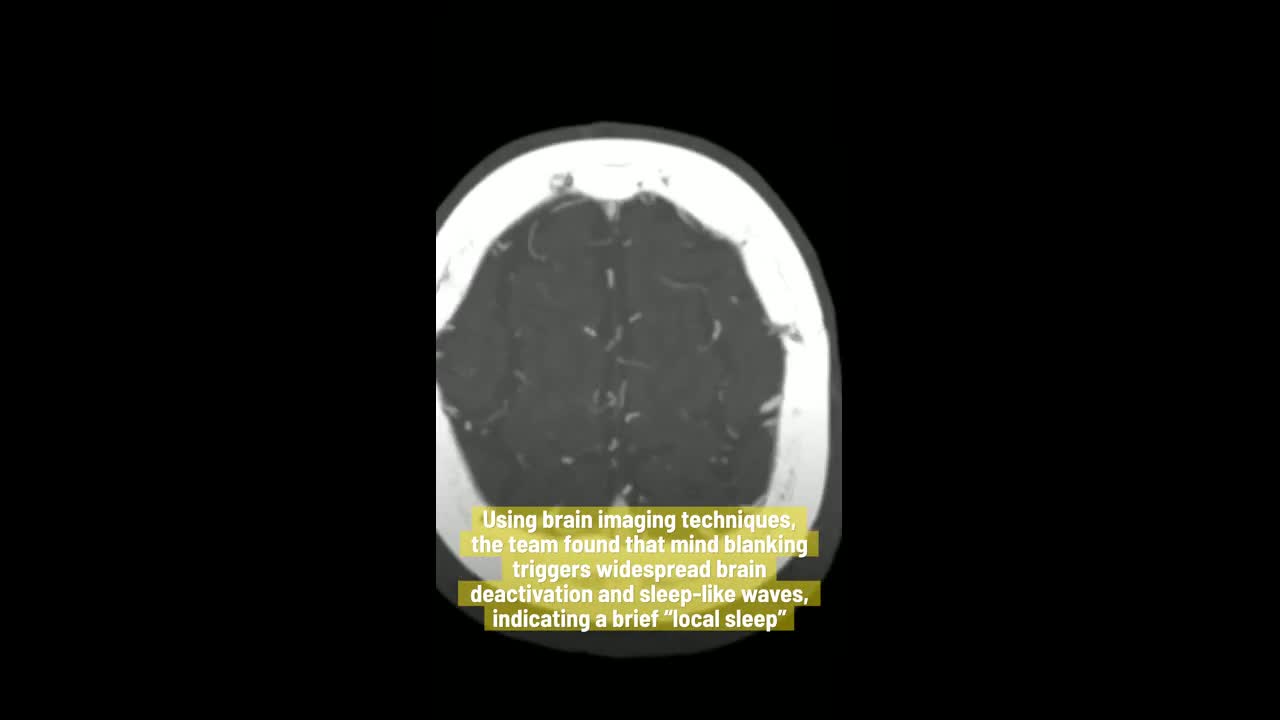 what-happens-when-your-mind-goes-blank-here-s-the-science