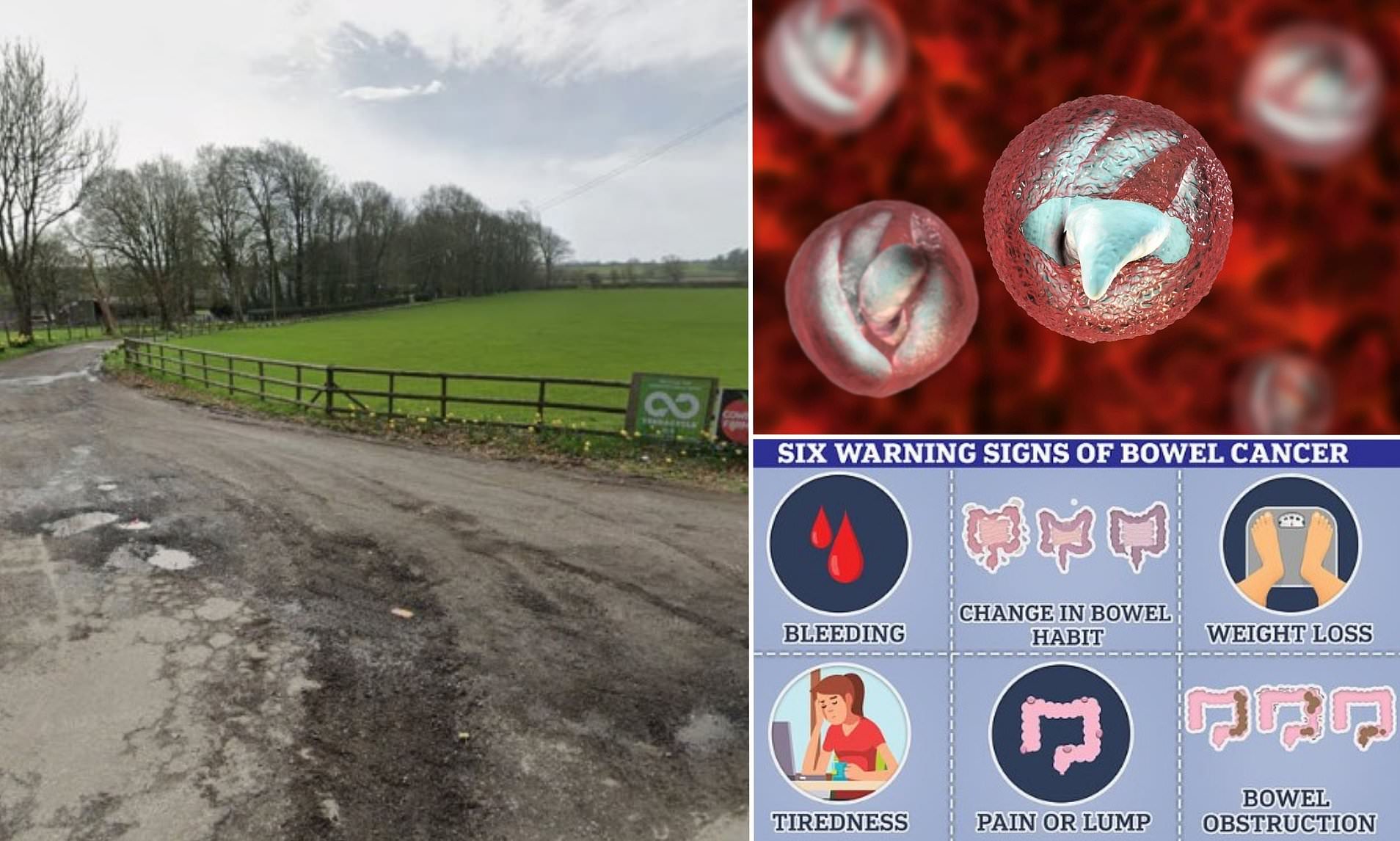 Warning over outbreak of grim parasite that causes 'bowel cancer-like ...