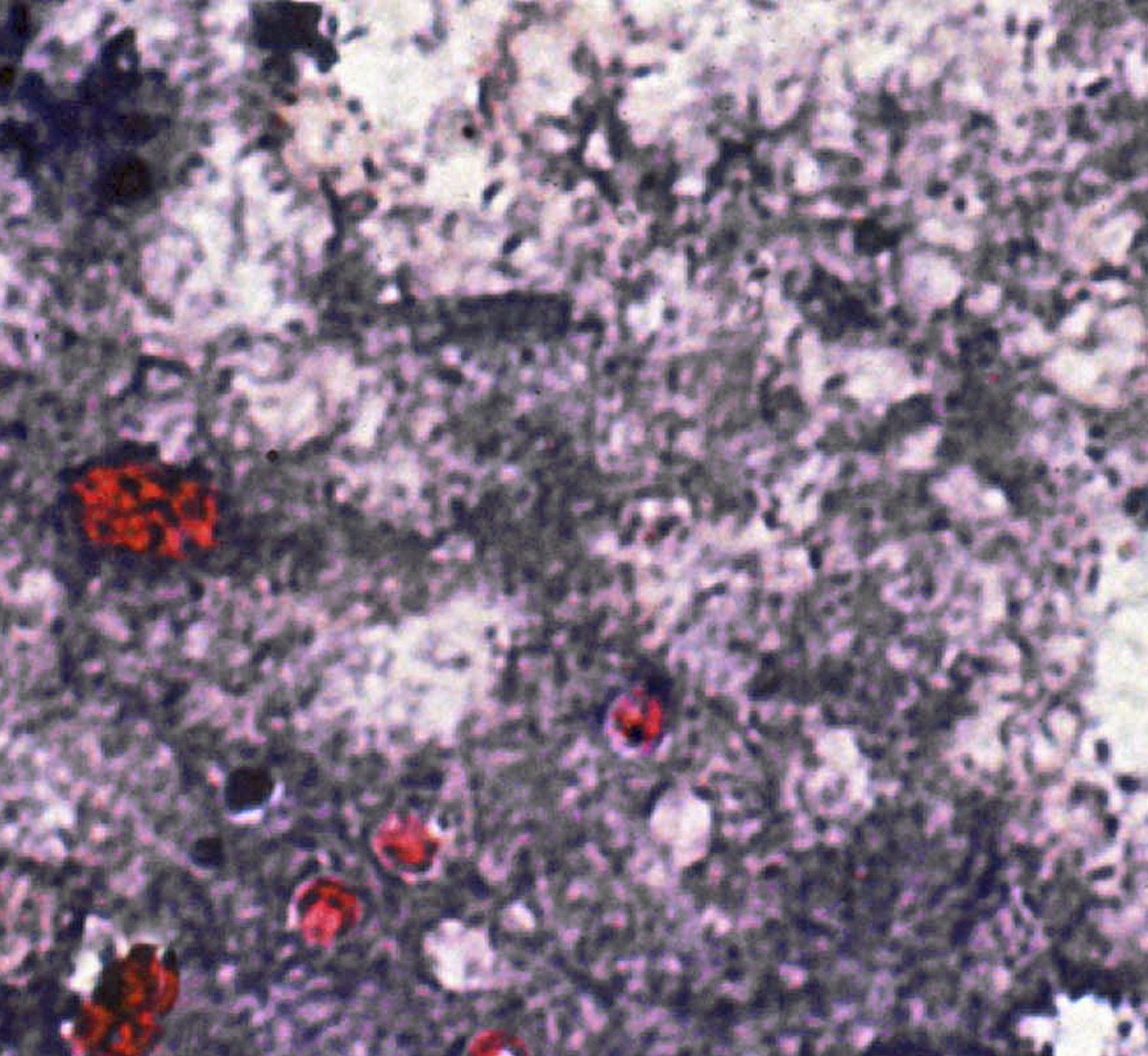 More than 70 people now infected with parasite after visiting petting zoo