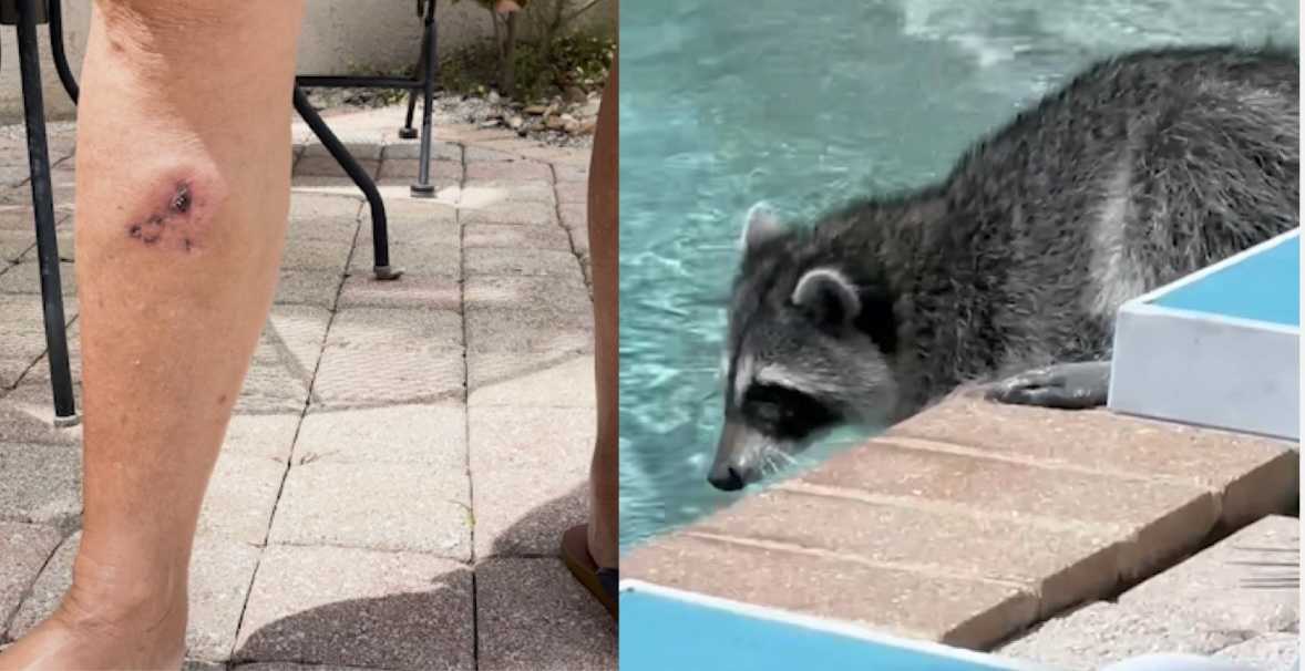 Wildlife encounter gone wrong; Florida woman attacked by raccoon