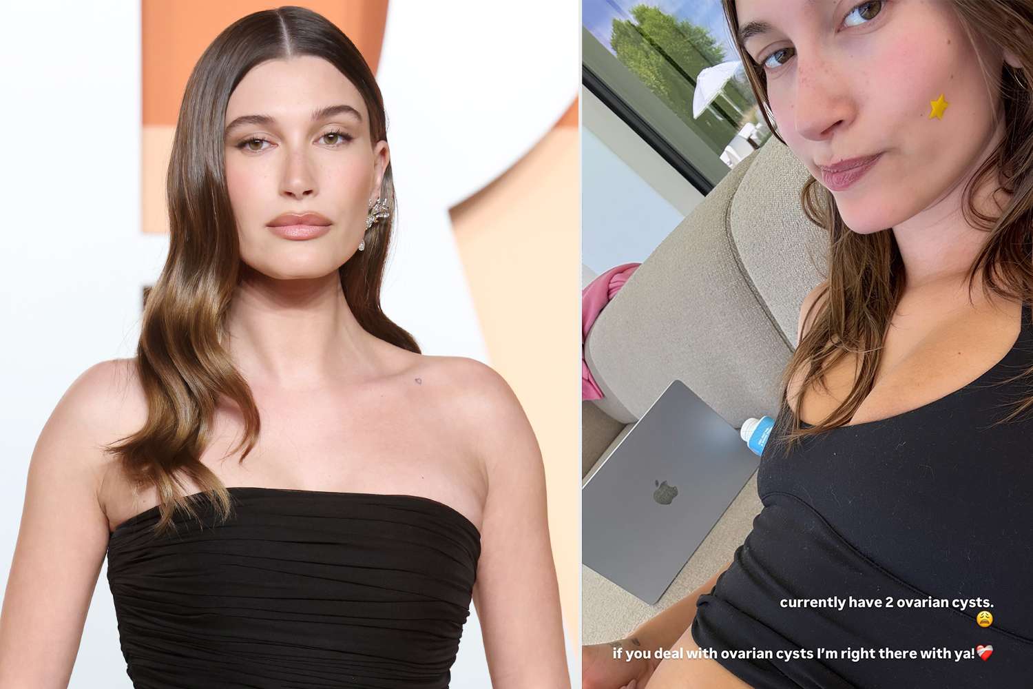 Hailey Bieber Reveals She Has 2 Ovarian Cysts(02)