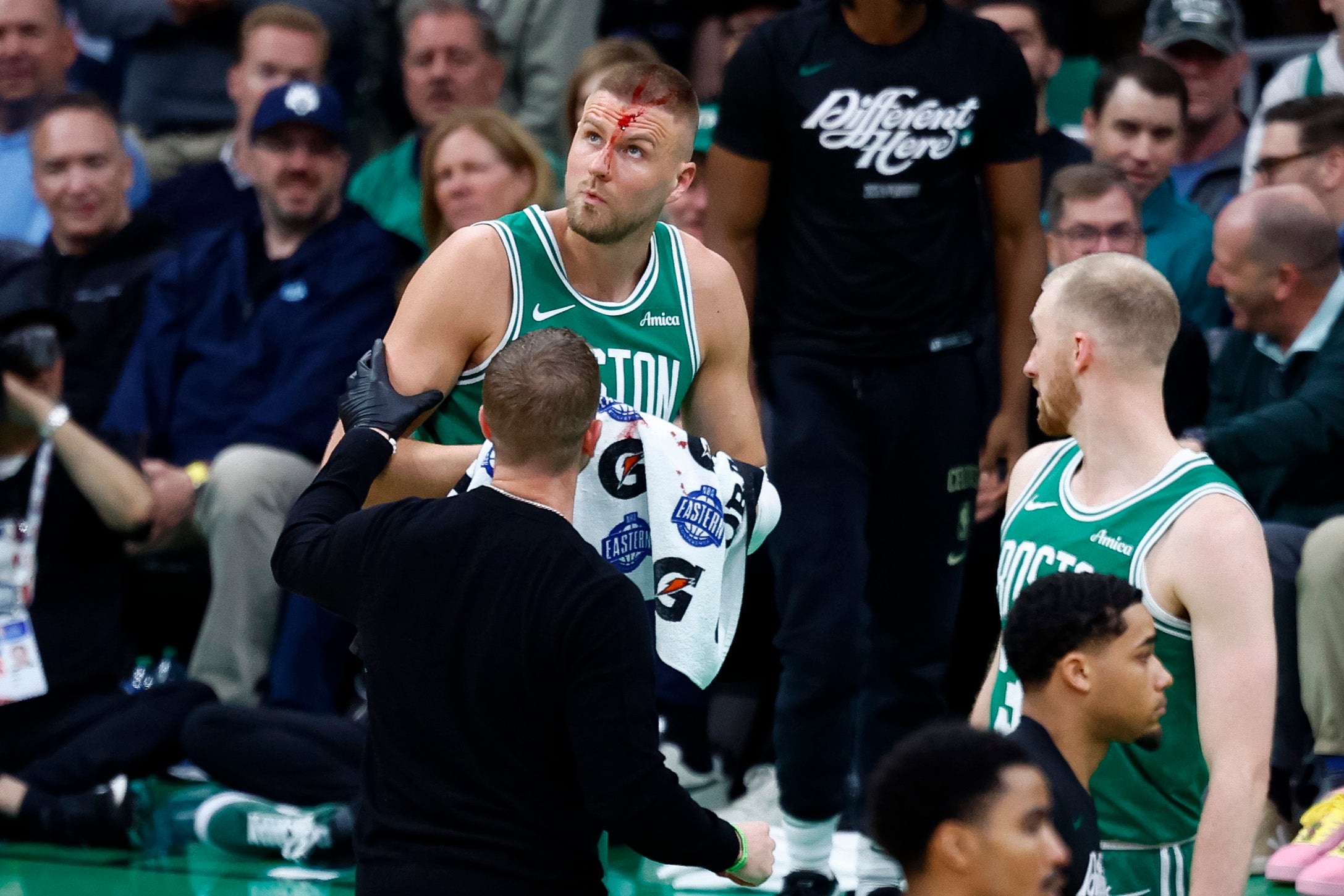 A bloodied Kristaps Porzingis embraces his ‘WWE moment’ in Celtics Game
