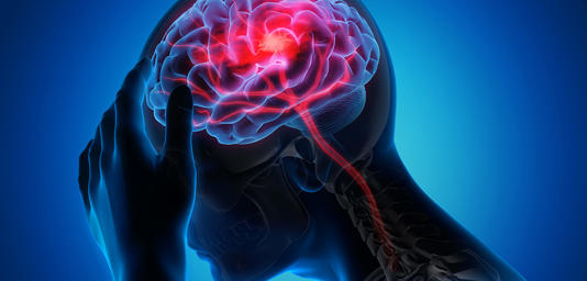 I segnali d’allarme dell’aneurisma cerebrale: riconoscerli può salvare la vita​