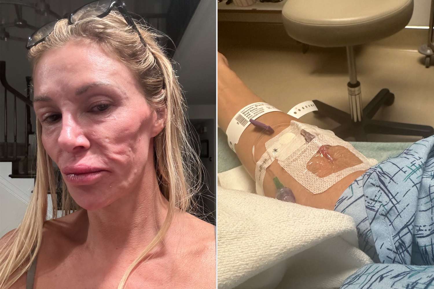 Brandi Glanville Reveals She Called 911 After Waking Up to Find She Was