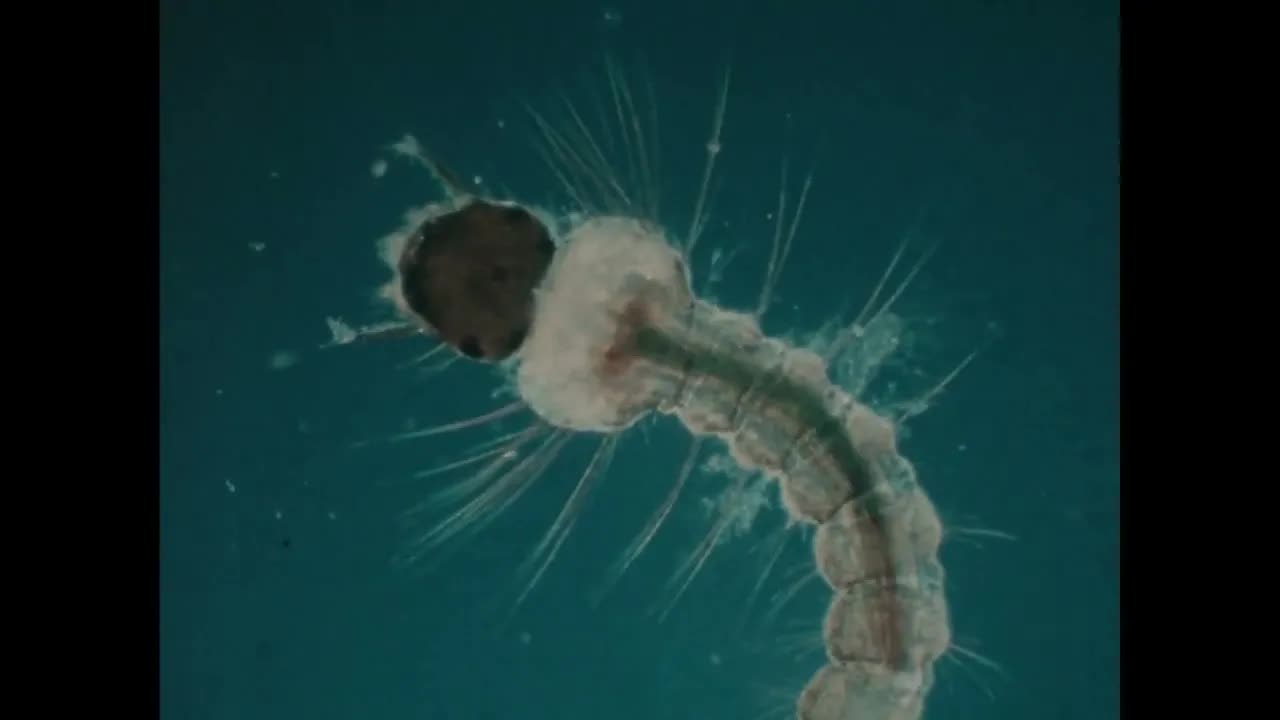 Microscopy: Exploring Pond Water Microorganisms