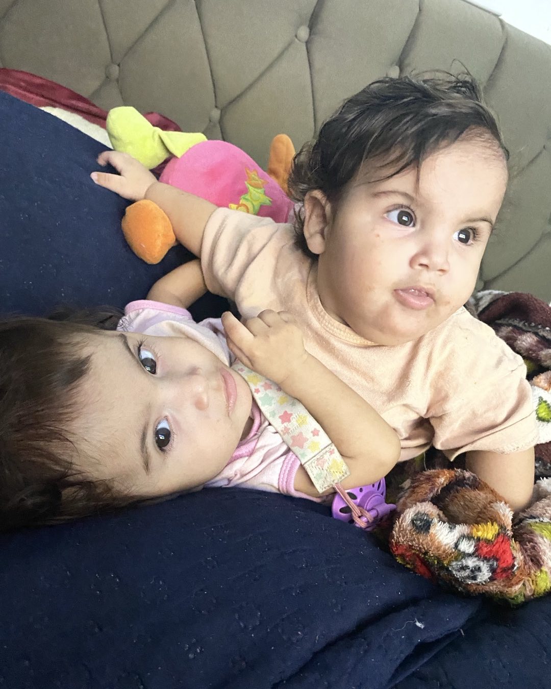 Gêmeas siamesas são separadas com sucesso em cirurgia feita pelo SUS