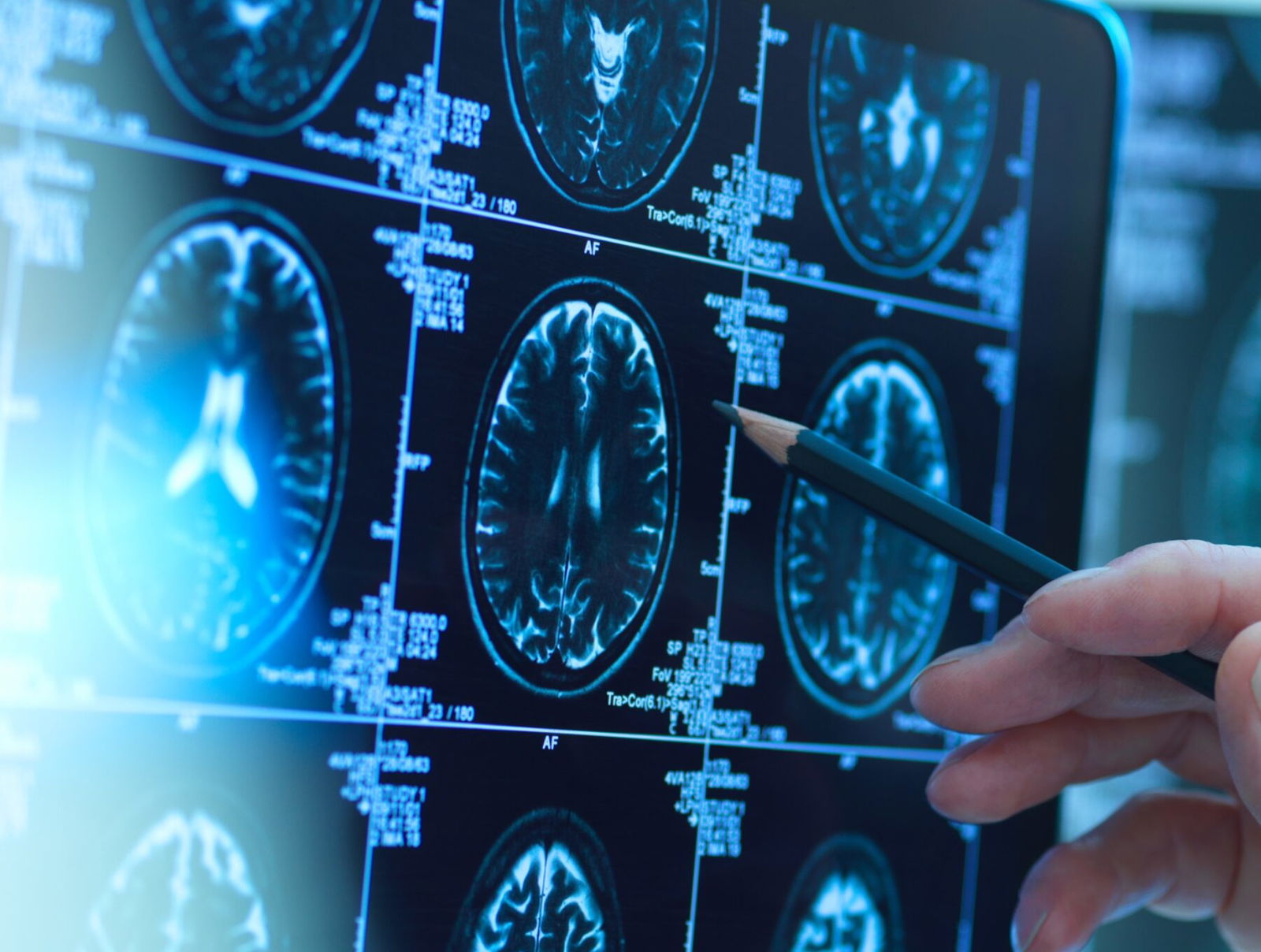 Why Walking Could Decrease Alzheimer's In The Black Community